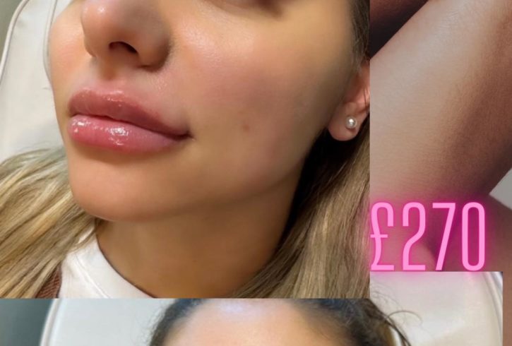 Salon Tratamente Faciale Si Botox In Croydon, Londra