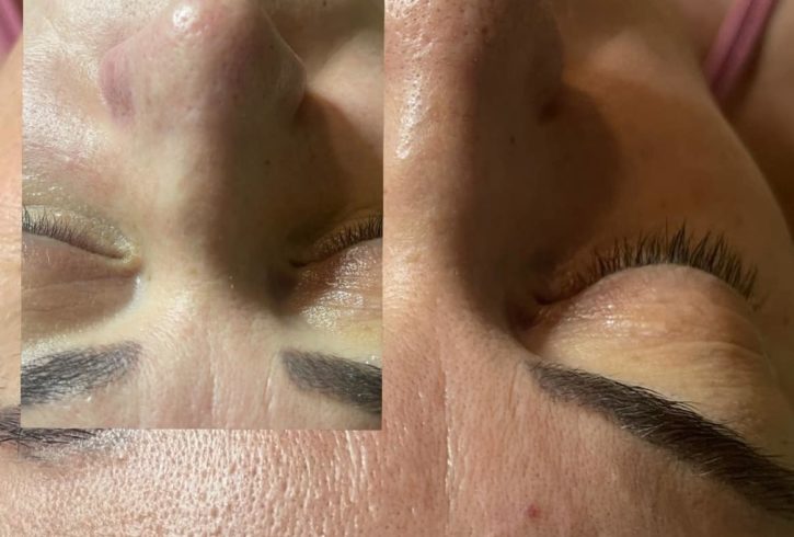 Salon De Remodelare Corporala Si Faciala In Harrow, Londra