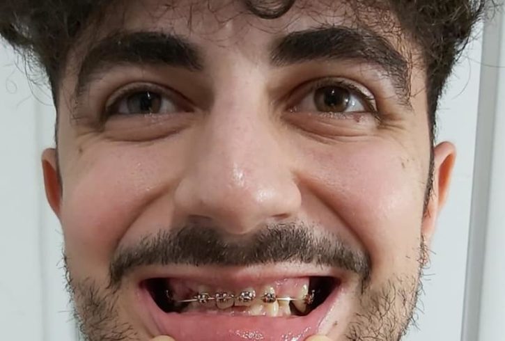 Servicii Stomatologice Implanturi in Leicester, UK Servicii Stomatologice Implanturi in Leicester, UK